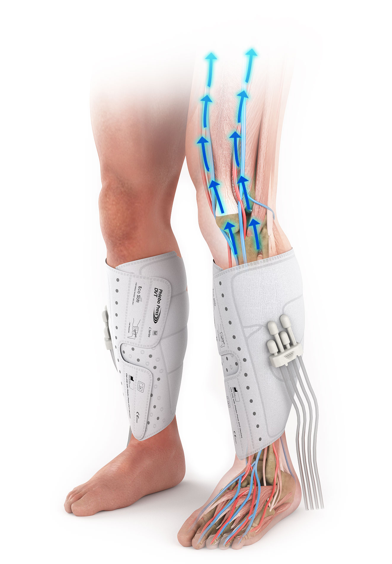 Phlebo Press® Eco Soft DVT-Manschetten am Unterschenkel — Förderung des venösen Rückstroms